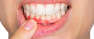 Способы исследования полости рта
